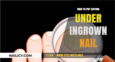 Relieve Ingrown Nail Pain: Simple Cotton Placement Guide for Quick Relief
