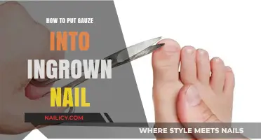 Effective Gauze Application for Ingrown Nail Relief: A Step-by-Step Guide