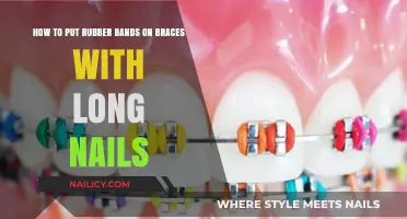 Long Nails and Braces: Rubber Band Application Tips