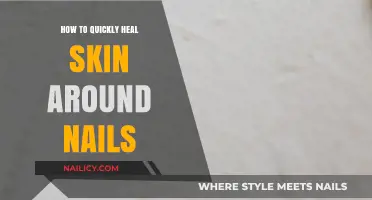 Effective Tips to Rapidly Heal and Soothe Skin Around Nails