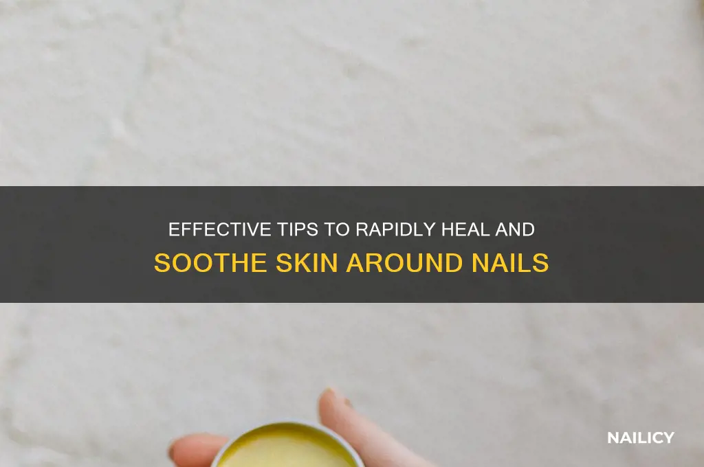 how to quickly heal skin around nails