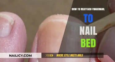 Reattaching a Fingernail: Step-by-Step Guide to Heal Your Nail Bed