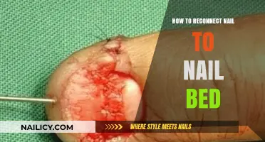 Effective Techniques to Reconnect a Nail to Its Nail Bed Safely