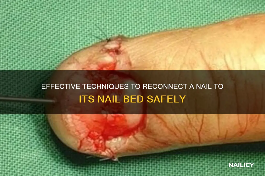 how to reconnect nail to nail bed