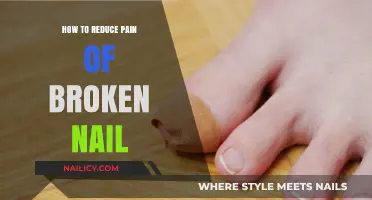 Quick Relief Tips to Soothe Pain from a Broken Nail
