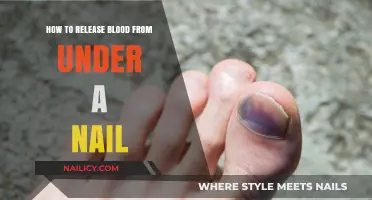 Relieve Pain and Pressure: Safe Steps to Drain Blood Under a Nail
