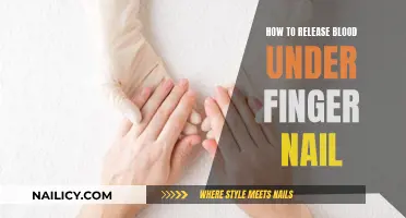 Relieving Blood Under Fingernails: Quick and Easy Methods
