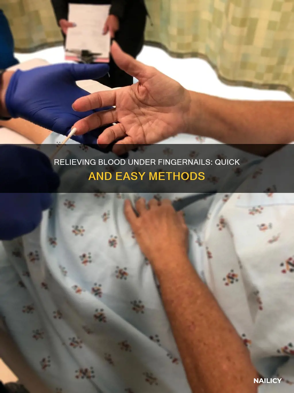 how to release blood under finger nail