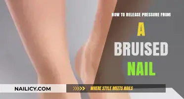 Relieve Pain and Heal: Effective Ways to Release Pressure from a Bruised Nail