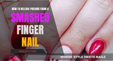 Relieve Smashed Fingernail Pressure: Quick and Easy Home Remedies