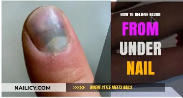 Quick Relief: How to Safely Treat Blood Under Your Nail