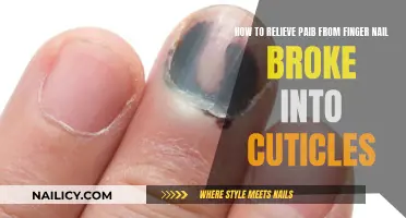 Relieving Pain from a Broken Fingernail: Home Remedies