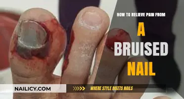 Quick Relief Tips for Painful Bruised Nails: A Comprehensive Guide