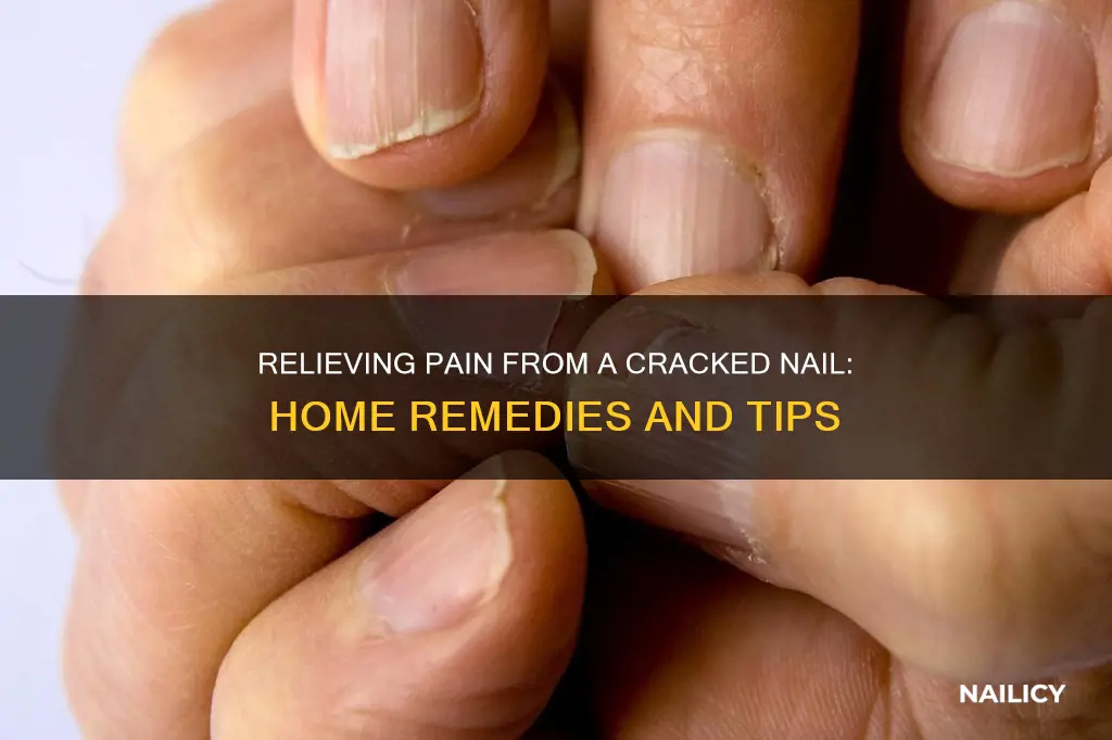 how to relieve pain from cracked nail on the finger