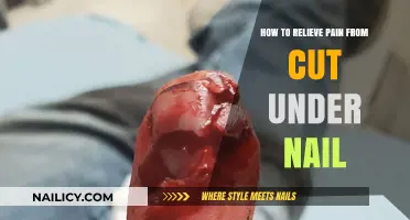 Quick Home Remedies for Painful Nail Cuts
