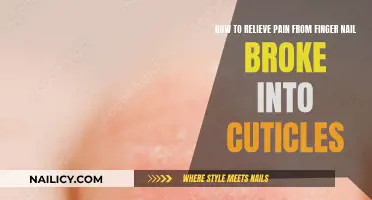 Relieving Pain from a Broken Fingernail: Quick Home Remedies