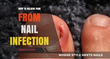 Effective Remedies to Relieve Pain from Nail Infections Quickly