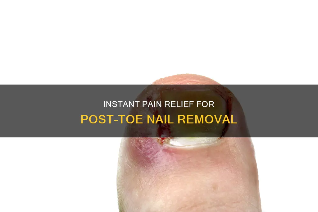 how to relieve pain from removing toe nail