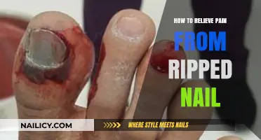 Quick Relief Tips for Painful Ripped Nail Injuries at Home