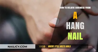 Quick Remedies to Soothe and Heal Hang Nail Soreness Fast