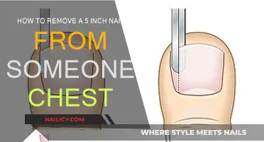 Emergency Response: Nail Extraction from Chest