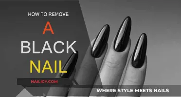 Effective Ways to Treat and Remove a Black Nail