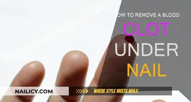 Treating Blood Clots Under Nails: Quick Guide