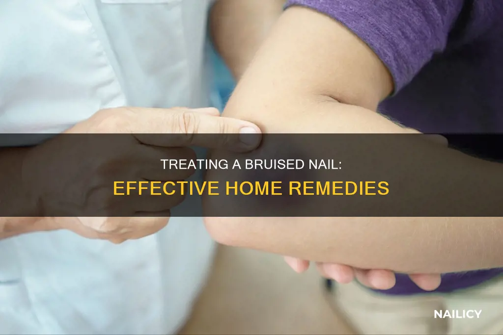how to remove a bruised nail