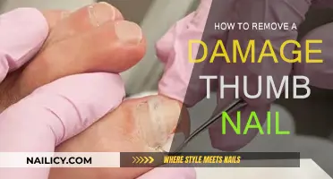 Effective Ways to Remove a Damaged Thumb Nail