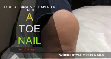 Efficient Splinter Removal: Toe Nail Relief
