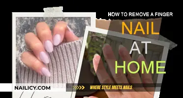 Effective Home Remedies to Remove Fingernails