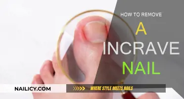 Effective Methods to Remove an Ingrown Toenail at Home