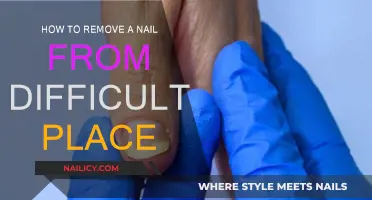 Extracting Nails: Tips for Tricky Spots