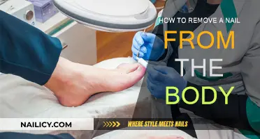 Nail Removal: A Step-by-Step Guide