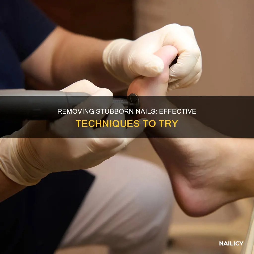how to remove a nail that won