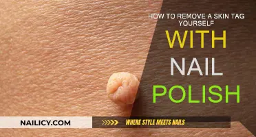 Effective Home Remedy: Nail Polish for Skin Tag Removal