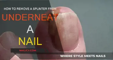 Removing Splinters: Quick Nail-Saving Solutions