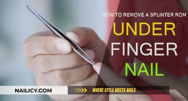 Removing Splinters: Quick Fix for Under Fingernails