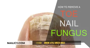 Eradicating Toenail Fungus: A Step-by-Step Guide