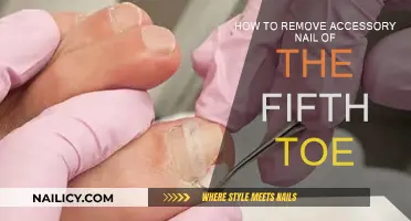 Effective Ways to Remove Accessory Nails on Your Small Toes