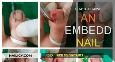 Removing Embedded Nails: A Step-by-Step Guide