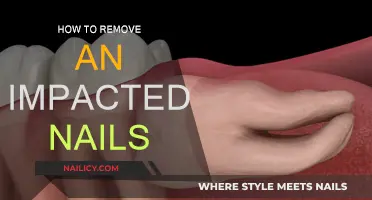Quickly and Safely Remove an Ingrown Toenail