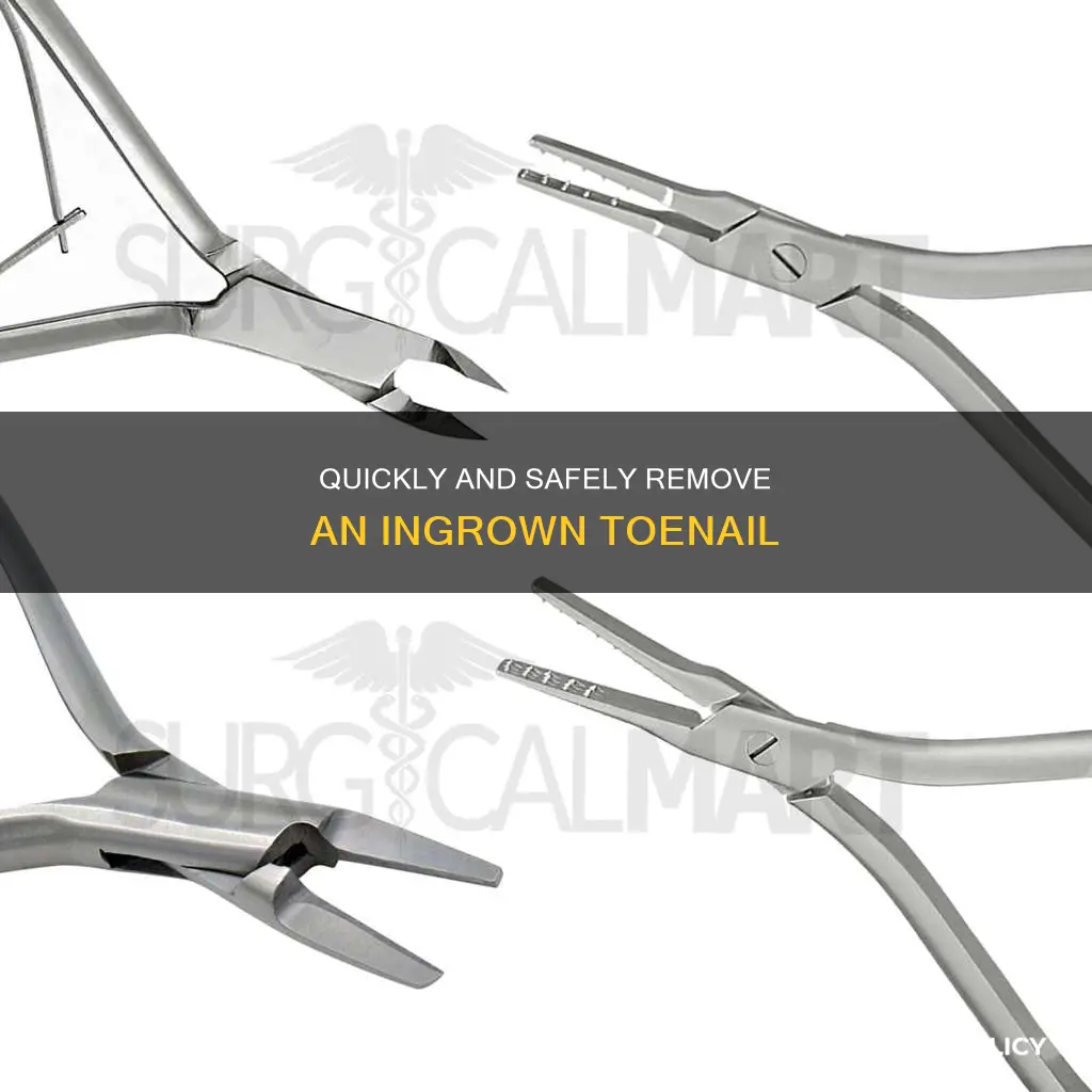 how to remove an impacted nails
