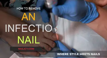 Treating an Infected Nail: Steps to Take