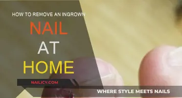 Home Treatment for Ingrown Nails