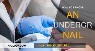 Effective Methods to Remove an Ingrown Toenail