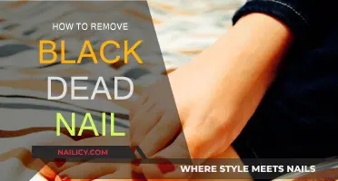 Get Rid of Black Dead Nails: Effective Home Remedies