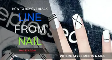 Eradicating Black Lines from Nails: A Simple Guide