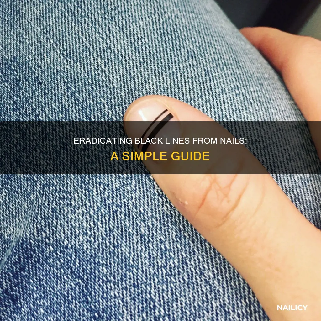 how to remove black line from nail