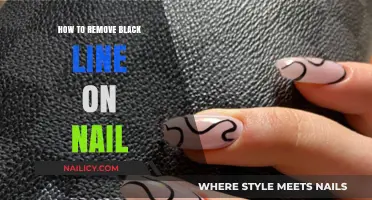 Eradicating Black Lines on Nails: A Simple Guide